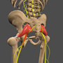 Sciatica